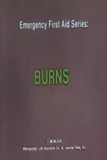 Poster for Emergency First Aid Series: Burns