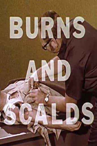 Poster for Burns And Scalds